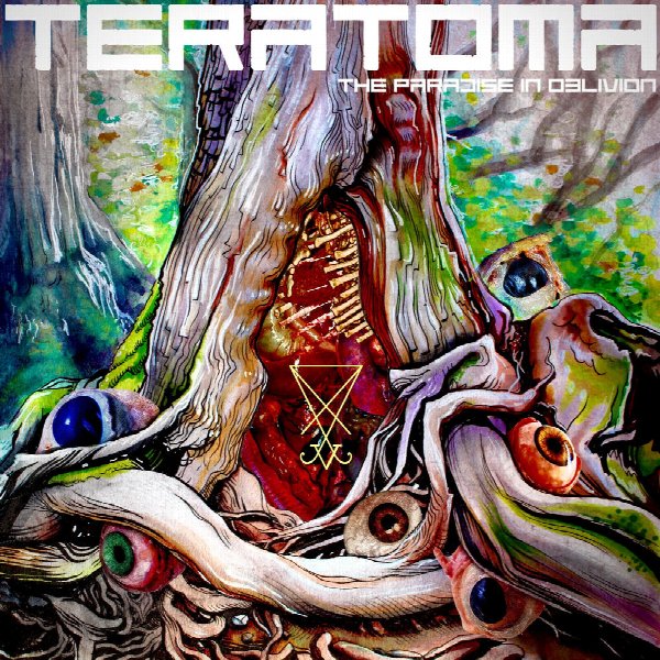 Teratoma
