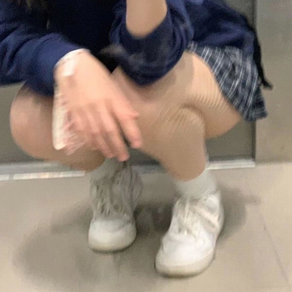 Eyesore